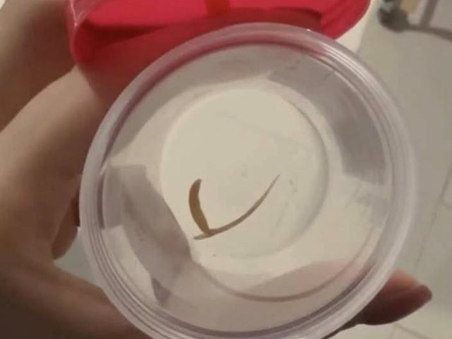 קרדיט צילום: בית החולים וולפסון